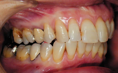 歯科疾患成立のメカニズム